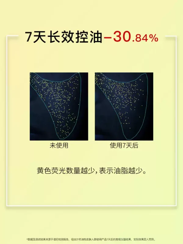 O1CN015WcpDg1vcuK3mwHFu_2206539036194.jpg_q50.jpg_.webp John Jeff烟酰胺精华液控油提亮肤色毛孔适合油皮面部精华姐夫