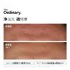 O1CN0170RRee1zk0vCplnGj_2214222556751.jpg_q50.jpg_.webp The Ordinary10%烟酰胺+1%锌提亮控油收毛孔淡化痘印胺锌三控精华