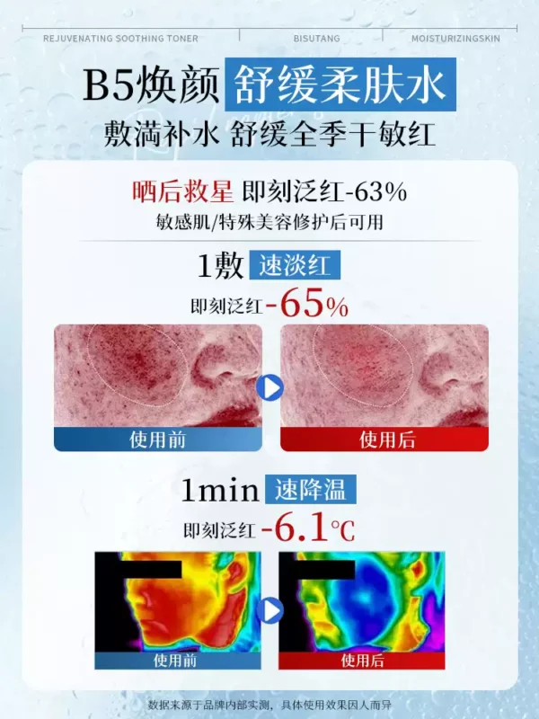O1CN01HdONKw1d84RhG2RlU_2217032103690-0-scmitem8000.jpg_q50.jpg_.webp B5积雪草舒缓爽肤水男女补水保湿收缩毛孔控油祛痘去黄提亮湿敷水