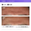 O1CN01MniAam1MHpXMtsSmC_2549841410.jpg_q50.jpg_.webp 【自营】The Ordinary10%烟酰胺+1%锌精华提亮控油改善痘痘30ml