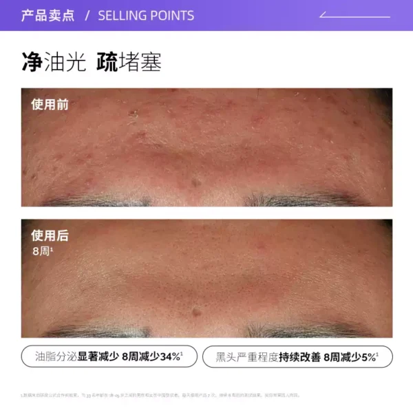 O1CN01MniAam1MHpXMtsSmC_2549841410.jpg_q50.jpg_.webp 【自营】The Ordinary10%烟酰胺+1%锌精华提亮控油改善痘痘30ml