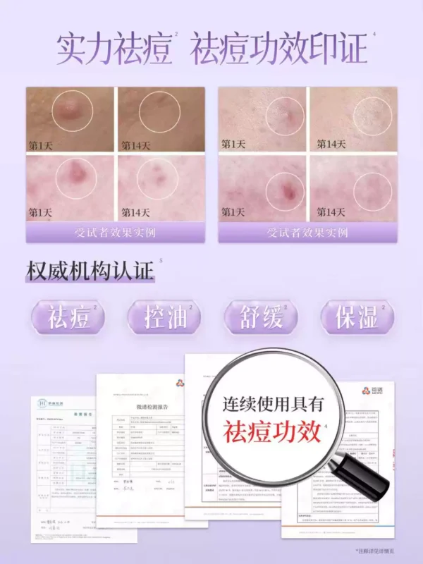 O1CN01zNKgOS2LZPLVu7bDd_1798839706.jpg_q50.jpg_.webp 戴春林紫玉膏祛痘控油精华面霜保湿清爽凝露男女护肤化妆品